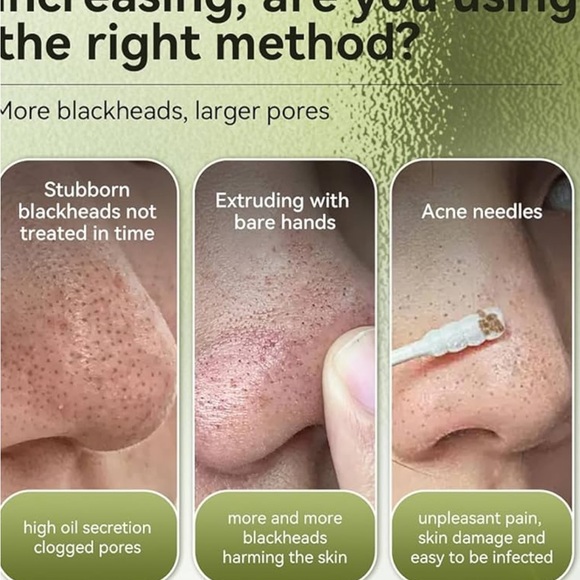 Set of 2 Lanbena Blackheads Removers Strips - Picture 6 of 6